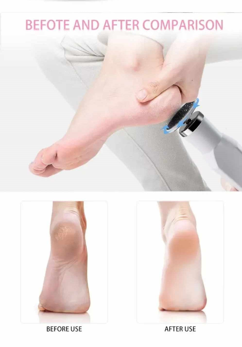 Electric Callus Portable Rechargeable Removal Machine